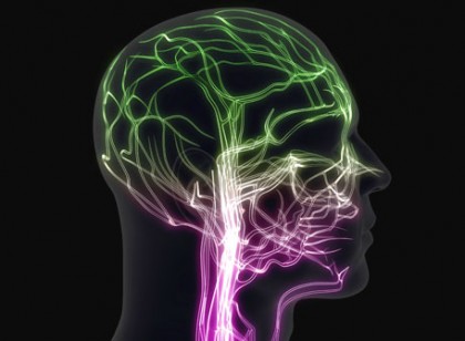 Migraines